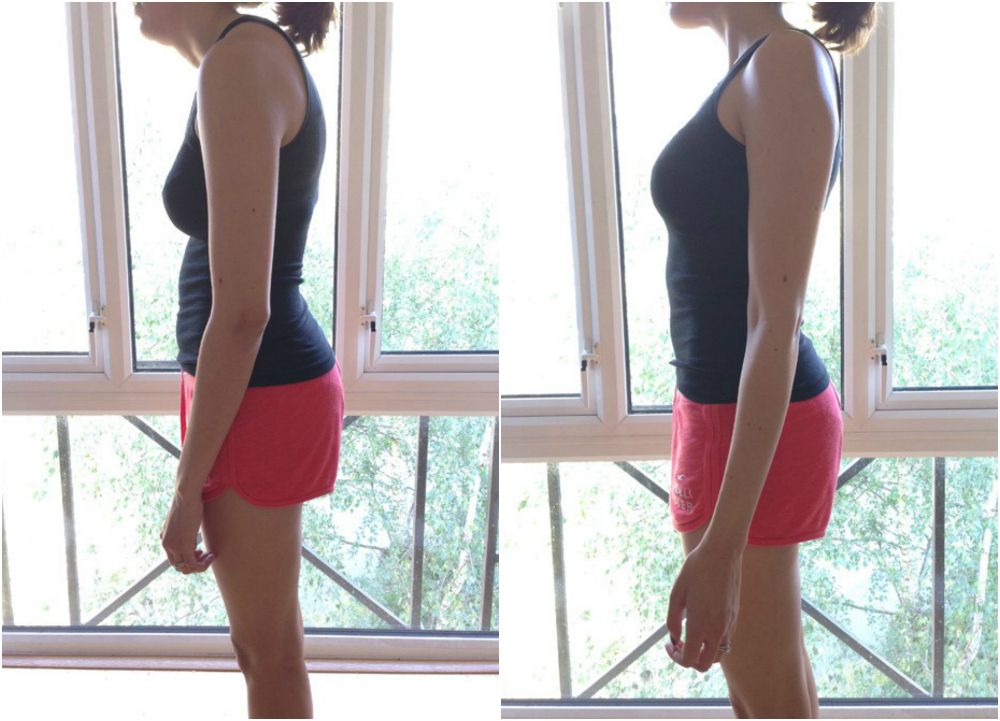 posture fixes 3