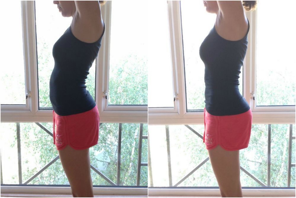 second posture fix